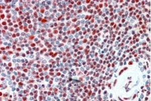 ABIN190786 (2. (ILF2 anticorps  (Internal Region))