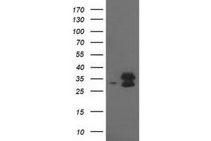 Western Blotting (WB) image for anti-Eukaryotic Translation Initiation Factor 4E Family Member 2 (EIF4E2) antibody (ABIN1497992) (EIF4E2 anticorps)