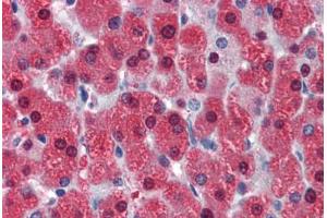 Human Liver (formalin-fixed, paraffin-embedded) stained with LASS2 antibody ABIN462181 followed by biotinylated goat anti-rabbit IgG secondary antibody ABIN481713, alkaline phosphatase-streptavidin and chromogen.