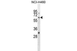 WHSC2 Antibody (Center) western blot analysis in NCI-H460 cell line lysates (35 µg/lane). (WHSC2 anticorps  (Middle Region))