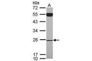 Image no. 1 for anti-YEATS Domain Containing 4 (AA 1-203) antibody (ABIN1501789) (GAS41 anticorps  (AA 1-203))
