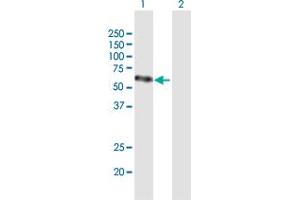 Western Blot analysis of VEGFC expression in transfected 293T cell line by VEGFC MaxPab polyclonal antibody. (VEGFC anticorps  (AA 1-419))