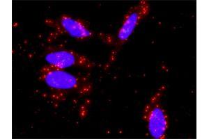Proximity Ligation Analysis of protein-protein interactions between STAT1 and STAT5A. (STAT5A anticorps  (AA 1-104))