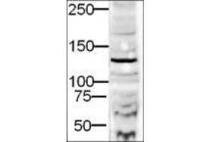 Image no. 1 for anti-Diaphanous Homolog 2 (DIAPH2) (AA 1085-1101) antibody (ABIN199948) (DIAPH2 anticorps  (AA 1085-1101))
