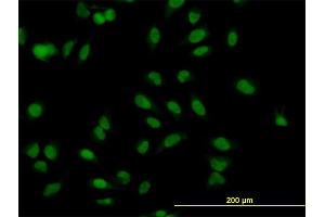 Immunofluorescence of monoclonal antibody to MBNL1 on HeLa cell.