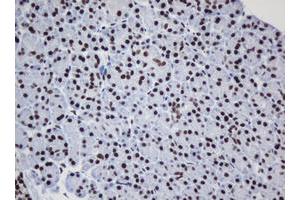 Image no. 6 for anti-Decapping Enzyme, Scavenger (DCPS) antibody (ABIN1497780) (DCPS anticorps)