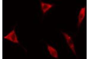 ABIN6267620 staining HeLa cells by IF/ICC.