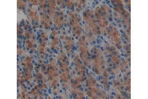 Used in DAB staining on fromalin fixed paraffin- embedded stomach tissue