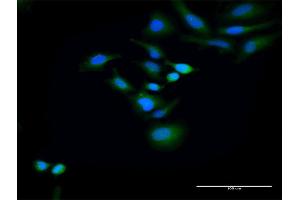 Immunofluorescence of purified MaxPab antibody to HOMER2 on HeLa cell.