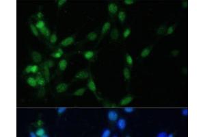 Immunofluorescence analysis of NIH-3T3 cells using MAD2L1 Polyclonal Antibody at dilution of 1:100 (40x lens). (MAD2L1 anticorps)