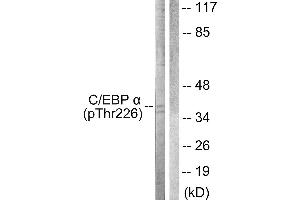 Western blot analysis of extracts from COS7 cells, treated with EGF (200ng/ml, 30mins), using C/EBP-α (Phospho-Thr226) antibody. (CEBPA anticorps  (pThr226))