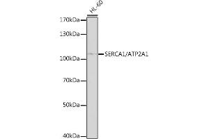 Western blot analysis of extracts of HL-60 cells, using SERC/SERC/ antibody (0104) at 1:1000 dilution. (ATP2A1/SERCA1 anticorps  (AA 350-600))