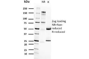 SDS-PAGE Analysis Purified RET Mouse Monoclonal Antibody (RET/2662). (Ret Proto-Oncogene anticorps  (AA 702-848))