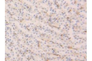 Detection of FABP4 in Mouse Kidney Tissue using Polyclonal Antibody to Fatty Acid Binding Protein 4 (FABP4)