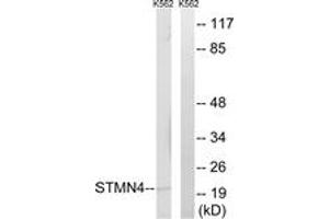 Western blot analysis of extracts from K562 cells, using STMN4 Antibody. (STMN4 anticorps  (AA 140-189))