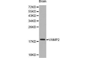 Western Blotting (WB) image for anti-Vesicle-Associated Membrane Protein 2 (Synaptobrevin 2) (VAMP2) (AA 1-100) antibody (ABIN1513674) (VAMP2 anticorps  (AA 1-100))