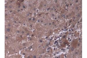 DAB staining on IHC-P; Samples: Human Liver Tissue (P4HA3 anticorps  (AA 227-544))