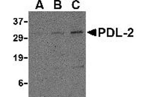 Western Blotting (WB) image for anti-Programmed Cell Death 1 Ligand 2 (PDCD1LG2) (Middle Region) antibody (ABIN1031035)