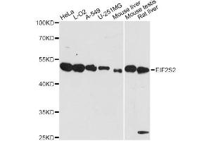 Western blot analysis of extracts of various cell lines, using EIF2S2 antibody. (EIF2S2 anticorps)