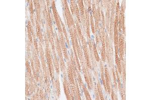 Immunohistochemistry of paraffin-embedded mouse heart using GRK5 antibody (ABIN1680115, ABIN3018251, ABIN3018252 and ABIN6220413) at dilution of 1:100 (40x lens).