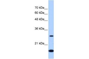 WB Suggested Anti-USE1 Antibody Titration:  2. (UBE2Z anticorps  (Middle Region))