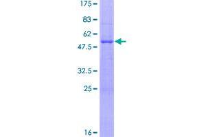 Image no. 1 for Fms-Related tyrosine Kinase 3 Ligand (FLT3LG) (AA 1-235) protein (GST tag) (ABIN1354222)