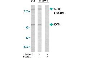 Western blot analysis of extracts from 293 and SK-OV-3 cells using IGF1R polyclonal antibody  .