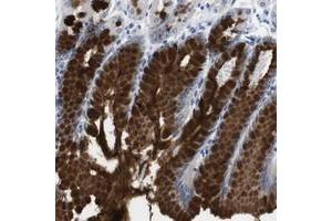 Immunohistochemical staining of human stomach with C1RL polyclonal antibody  shows strong cytoplasmic positivity in glandular cells. (C1RL anticorps)