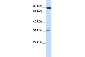 WB Suggested Anti-ADAM19 Antibody Titration:  0.