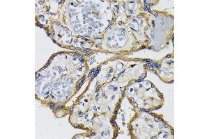 Immunohistochemistry of paraffin-embedded human placenta using IQG antibody (ABIN7268020) at dilution of 1:200 (40x lens). (IQGAP1 anticorps  (AA 500-750))