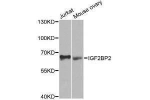Western blot analysis of extracts of various cell lines, using IGF2BP2 antibody. (IGF2BP2 anticorps  (C-Term))
