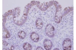 IHC-P Image Immunohistochemical analysis of paraffin-embedded human normal colon, using CCDC83, antibody at 1:500 dilution.