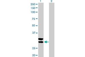 Western Blot analysis of TPSAB1 expression in transfected 293T cell line by TPSAB1 MaxPab polyclonal antibody. (TPSAB1 anticorps  (AA 1-275))