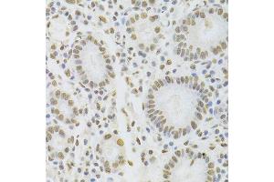 Immunohistochemistry of paraffin-embedded human stomach using HNRNPD Antibody.