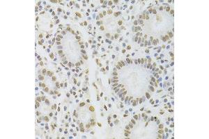 Immunohistochemistry of paraffin-embedded human stomach using HNRNPD Antibody. (HNRNPD/AUF1 anticorps  (AA 1-306))