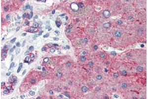Human Liver (formalin-fixed, paraffin-embedded) stained with CLDN1 antibody ABIN457476 at 5 ug/ml followed by biotinylated goat anti-rabbit IgG secondary antibody ABIN481713, alkaline phosphatase-streptavidin and chromogen. (Claudin 1 anticorps  (C-Term))