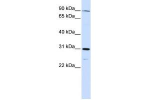 WB Suggested Anti-LONRF3 Antibody Titration:  0. (LONRF3 anticorps  (N-Term))