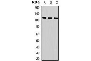 Western blot analysis of SUPT16H expression in Hela (A), A549 (B), Jurkat (C) whole cell lysates. (SUPT16H anticorps  (C-Term))