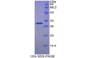 SDS-PAGE (SDS) image for Adenosine Kinase (ADK) (AA 94-339) protein (His tag) (ABIN1878005) (ADK Protein (AA 94-339) (His tag))