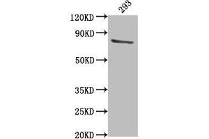 Western Blot Positive WB detected in: 293 whole cell lysate All lanes: TBK1 antibody at 1:2000 Secondary Goat polyclonal to rabbit IgG at 1/50000 dilution Predicted band size: 84 kDa Observed band size: 84 kDa (TBK1 anticorps  (AA 644-661))