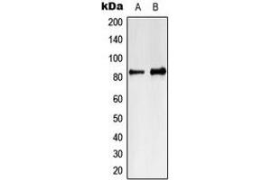 Western blot analysis of MARK4 expression in Jurkat (A), K562 (B) whole cell lysates. (MARK4 anticorps  (Center))