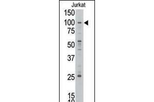 Western blot analysis of anti-MLLT10 Pab in Jurkat cell line lysate. (MLLT10 anticorps  (C-Term))