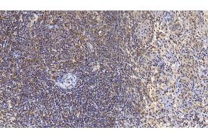 Detection of VF in Human Spleen Tissue using Monoclonal Antibody to Visfatin (VF) (NAMPT anticorps  (AA 1-491))