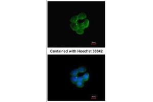 ICC/IF Image Immunofluorescence analysis of methanol-fixed A431, using NNT, antibody at 1:200 dilution. (NNT anticorps  (C-Term))