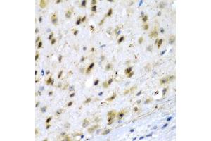 Immunohistochemistry of paraffin-embedded mouse brain using TPH2 antibody (ABIN5974298) at dilution of 1/200 (40x lens). (Tryptophan Hydroxylase 2 anticorps)