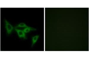 Immunofluorescence analysis of LOVO cells, using OR2I1 Antibody.