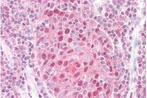 ABIN184996 (5µg/ml) staining of paraffin embedded Human Tonsil.