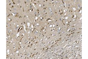 IHC analysis of CD34 using anti-CD34 antibody (ABIN7600282). (CD34 anticorps  (AA 170-386))