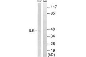 Western blot analysis of extracts from rat liver cells, using ILK (Ab-246) Antibody. (ILK anticorps  (AA 212-261))