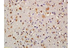 Formalin-fixed and paraffin embedded mouse brain labeled with Anti-Bid Polyclonal Antibody, Unconjugated  at 1:200 followed by conjugation to the secondary antibody and DAB staining (BID anticorps  (AA 102-195))
